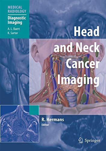 Stock image for Head and Neck Cancer Imaging (Medical Radiology) for sale by Mispah books