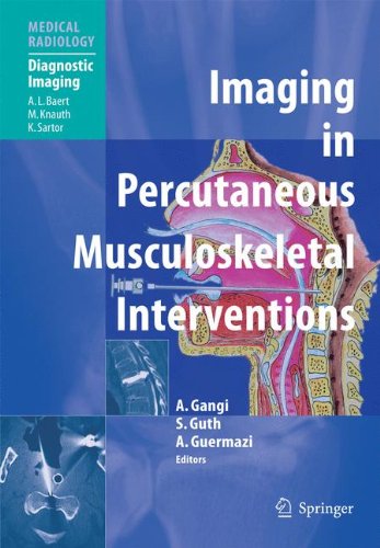 9783540220978: Imaging in Percutaneous Musculoskeletal Interventions (Medical Radiology)