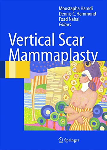 9783540221012: Vertical Scar Mammaplasty