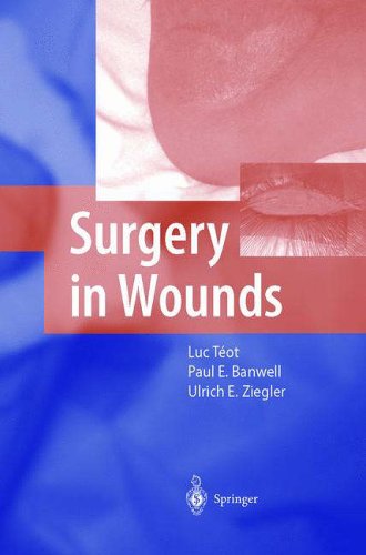 Stock image for Surgery in Wounds for sale by HPB-Red
