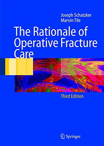 Imagen de archivo de The Rationale of Operative Fracture Care a la venta por Greener Books