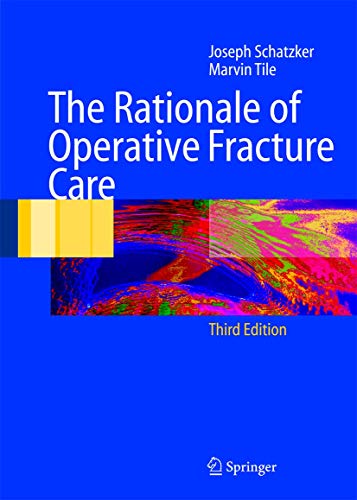 Stock image for The Rationale of Operative Fracture Care for sale by Greener Books