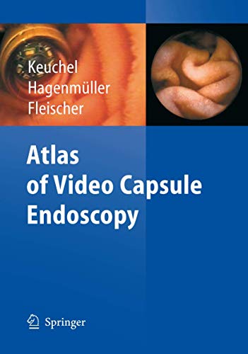 Stock image for Atlas of Video Capsule Endoscopy for sale by Smith Family Bookstore Downtown