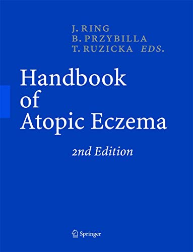 Handbook of Atopic Eczema - Ring, Johannes, Bernhard Przybilla und Thomas Ruzicka