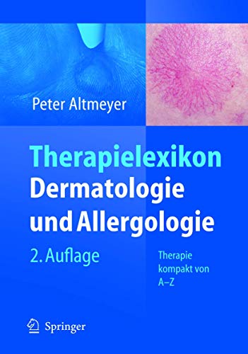 Stock image for Therapielexikon Dermatologie und Allergologie: Therapie kompakt von A-Z for sale by medimops