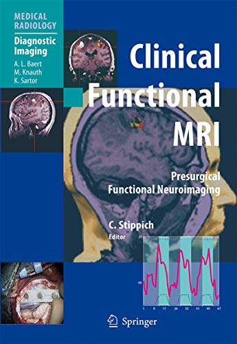9783540244691: Clinical Functional MRI: Presurgical Functional Neuroimaging