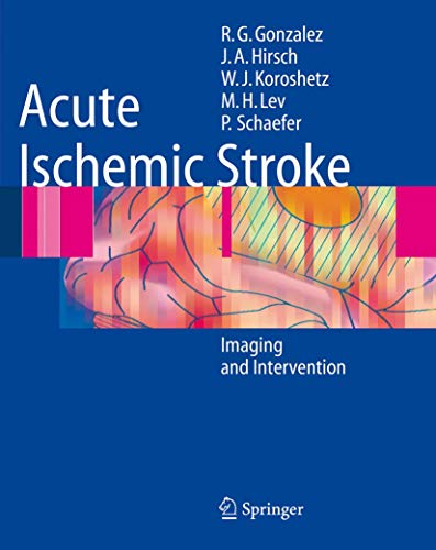 9783540252641: Acute Ischemic Stroke: Imaging And Intervention