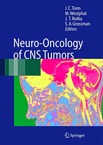 Neuro-Oncology of CNS Tumors.