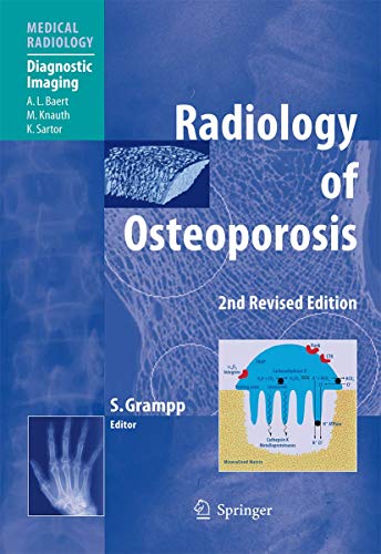 9783540258889: Radiology of Osteoporosis