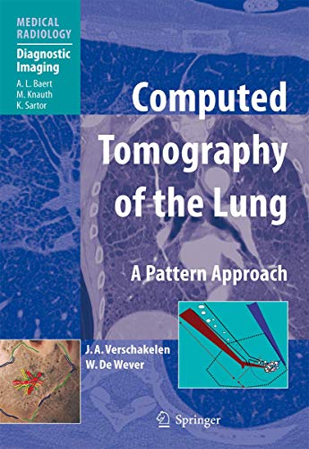 9783540261872: Computed Tomography of the Lung: A Pattern Approach (Medical Radiology / Diagnostic Imaging)