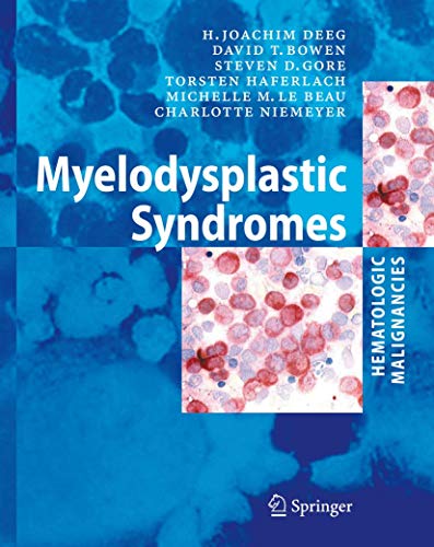 9783540261889: Hematologic Malignancies : Myelodysplastic Syndromes