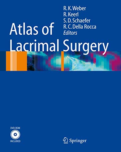 9783540262558: Atlas of Lacrimal Surgery