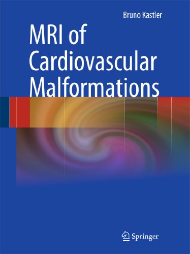 Stock image for MRI of Cardiovascular Malformations for sale by Blackwell's