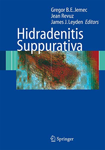 Stock image for HIDRADENITIS SUPPURATIVA for sale by BennettBooksLtd