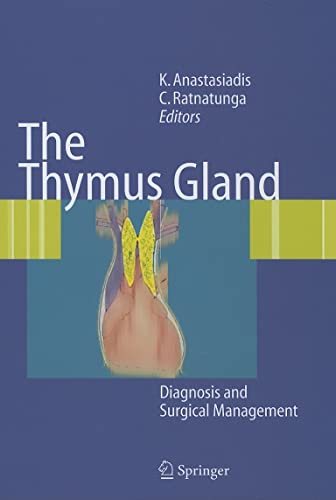 9783540334255: The Thymus Gland: Diagnosis and Surgical Management