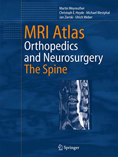 MRI Atlas: Orthopedics and Neurosurgery, The Spine (9783540335337) by Weyreuther, Martin; Heyde, Christoph E.; Westphal, Michael; Zierski, Jan; Weber, Ulrich