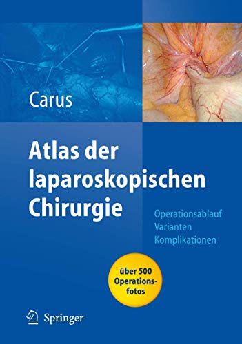 Beispielbild fr Operationsatlas Laparoskopische Chirurgie: Indikationen - Operationsablauf - Varianten - Komplikationen Mit Single Access Surgery zum Verkauf von medimops