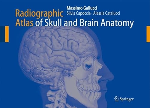 Imagen de archivo de Radiographic Atlas of Skull and Brain Anatomy a la venta por Books Puddle