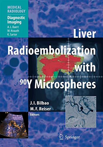 Stock image for Liver Radioembolization with 90Y Microspheres for sale by Books Puddle