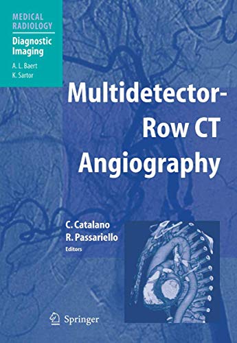 9783540401483: Multidetector-Row CT Angiography (Medical Radiology)