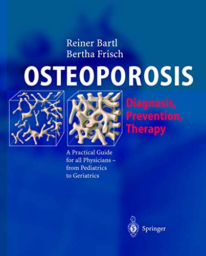 Stock image for Osteoporose-Manual: Diagnostik, Prävention und Therapie (German Edition) for sale by Once Upon A Time Books