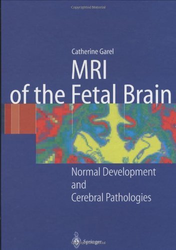 Immagine dell'editore per MRI of the Fetal Brain: Normal Development and Cerebral Pathologies venduto da Studibuch