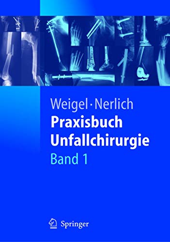 Praxisbuch Unfallchirurgie - Michael Nerlich Bernhard Weigel