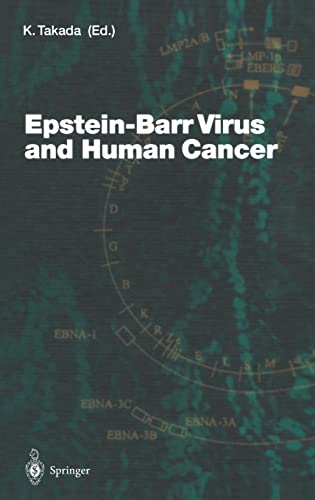 9783540415060: Epstein-Barr Virus and Human Cancer: v.258 (Current Topics in Microbiology and Immunology)