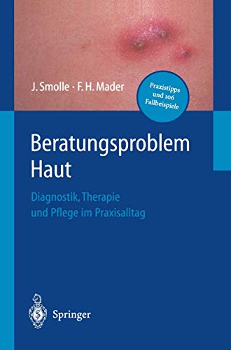 9783540417064: Beratungsproblem Haut: Diagnostik, Therapie Und Pflege Im Praxisalltag