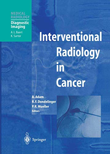 Stock image for Interventional Radiology in Cancer for sale by Revaluation Books