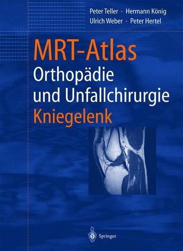 MRT-Atlas OrthopÃ¤die und Unfallchirurgie: Kniegelenk (German Edition) (9783540421054) by Teller, Peter; KÃ¶nig, Hermann; Weber, Ulrich; Hertel, Peter