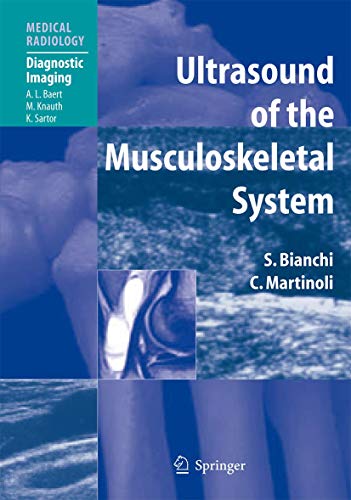 9783540422679: Ultrasound of the Musculoskeletal System (Diagnostic Imaging)
