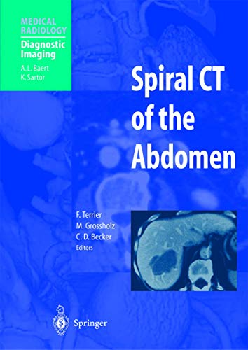 Stock image for Spiral CT of the Abdomen. for sale by Gast & Hoyer GmbH