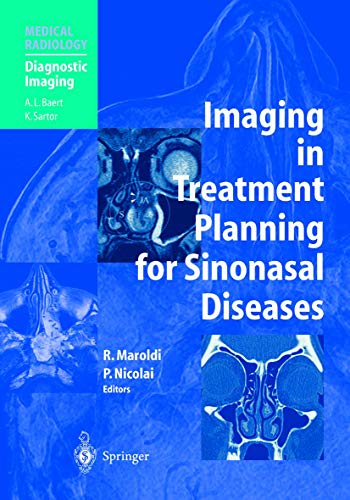 Beispielbild fr Imaging in Treatment Planning for Sinonasal Diseases zum Verkauf von Better World Books