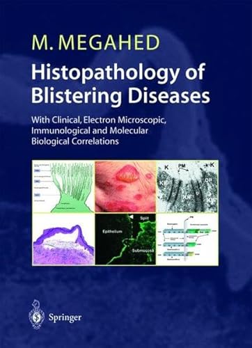 Beispielbild fr HISTOPATHOLOGY of BLISTERING DISEASES: with Clinical, Electron Microscopic, Immunological And Molecular Biological Correlations. Textbook and Atlas. With 371 Figures in 532 Separate Illustrations and 72 Tables. * zum Verkauf von L. Michael