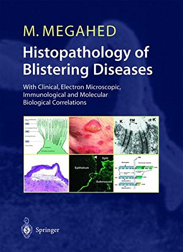 Stock image for HISTOPATHOLOGY of BLISTERING DISEASES: with Clinical, Electron Microscopic, Immunological And Molecular Biological Correlations. Textbook and Atlas. With 371 Figures in 532 Separate Illustrations and 72 Tables. * for sale by L. Michael