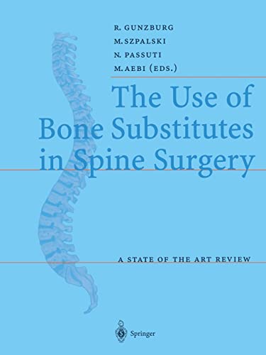 Beispielbild fr The Use of Bone Substitutes in Spine Surgery, A State of the Art Review. zum Verkauf von Antiquariat im Hufelandhaus GmbH  vormals Lange & Springer