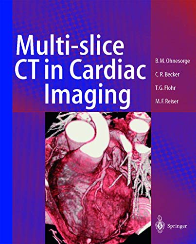 Stock image for Multislice CT in Cardiac Imaging: Technical Principles, Clincal Application and Future Developments for sale by WorldofBooks