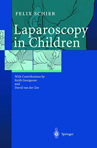 Beispielbild fr Laparoscopy in Children zum Verkauf von HPB-Red