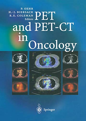 9783540431251: PET and PET-CT in Oncology