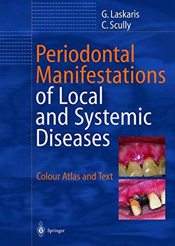 9783540432494: Periodontal Manifestations of Local and Systemic Diseases: Colour Atlas and Text