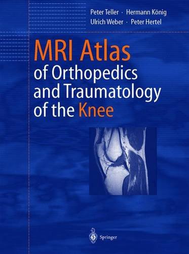 9783540440345: Mri Atlas of Orthopedics and Traumatology of the Knee Joint