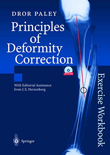 9783540441618: Principles of Deformity Correction: Exercise Workbook