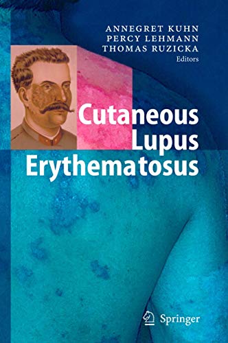 9783540442660: Cutaneous Lupus Erythematosus