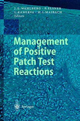 Imagen de archivo de Management of Positive Patch Test Reactions a la venta por Anybook.com