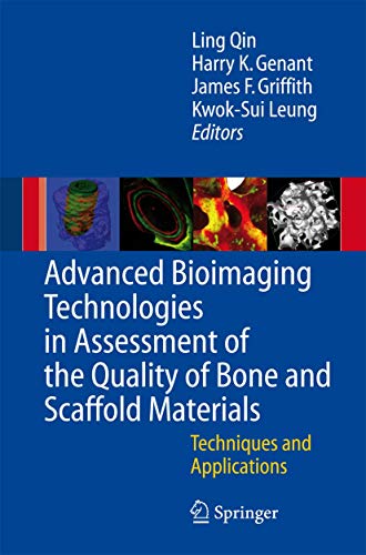 Stock image for Advanced Bioimaging Technologies in Assessment of the Quality of Bone and Scaffold Materials for sale by Kennys Bookshop and Art Galleries Ltd.