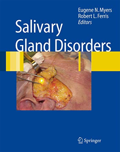 Stock image for Salivary Gland Disorders for sale by ThriftBooks-Dallas