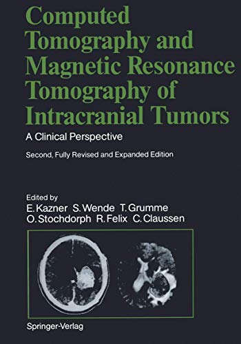Computed Tomography and Magnetic Resonance Tomography of Intracranial Tumors: A Clinical Perspective (9783540505761) by C. Claussen;O. Stochdorph;G. Sze;S. Wende;Sigurd Wende;Thomas Grumme;Otto Stochdorph;Roland Felix;Claus Claussen; Terry C. Telger;