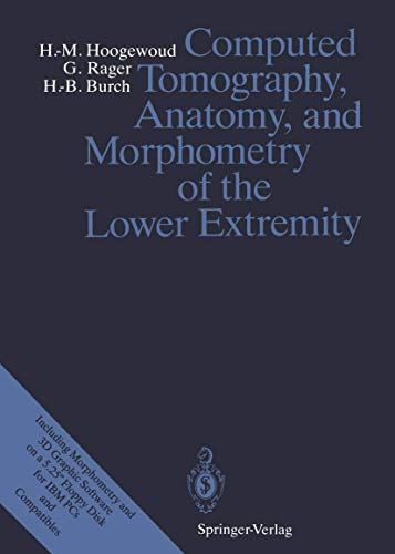 Imagen de archivo de Computed Tomography, Anatomy and Morphometry of the Lower Extremity a la venta por Books Puddle