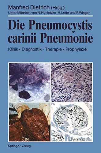 9783540511779: Die Pneumocystis carinii Pneumonie: Klinik  Diagnostik  Therapie  Prophylaxe